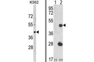(LEFT) Western blot analysis of LUC7L Antibody (C-term) in K562 cell line lysates (35ug/lane). (LUC7L Antikörper  (C-Term))