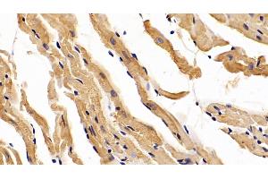 Detection of DPT in Mouse Cardiac Muscle Tissue using Polyclonal Antibody to Dermatopontin (DPT) (Dermatopontin Antikörper  (AA 29-197))