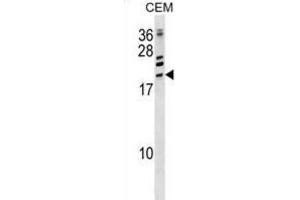 Western Blotting (WB) image for anti-Activating Transcription Factor 3 (ATF3) antibody (ABIN2998842)