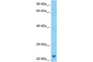 Host:  Rabbit  Target Name:  ASCL1  Sample Type:  RPMI-8226 Whole Cell lysates  Antibody Dilution:  1. (ASCL1 Antikörper  (N-Term))