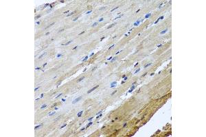Immunohistochemistry of paraffin-embedded rat heart using NUMA1 antibody. (NUMA1 Antikörper)