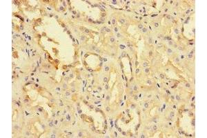 Immunohistochemistry of paraffin-embedded human kidney tissue using ABIN7173726 at dilution of 1:100 (TPPP3 Antikörper  (AA 2-176))