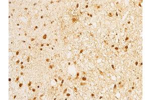 ABIN6267283 at 1/100 staining human brain tissue sections by IHC-P. (ErbB2/Her2 Antikörper  (pTyr1248))