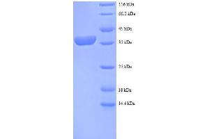 Ribosomal Protein S12 (RPS12) (AA 1-132), (full length) protein (GST tag)