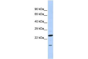 WB Suggested Anti-INSIG2 Antibody Titration:  0. (INSIG2 Antikörper  (N-Term))