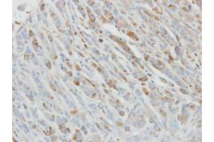 Immunohistochemistry (IHC) image for anti-Interleukin 1 Receptor Antagonist (IL1RN) antibody (ABIN2856394)