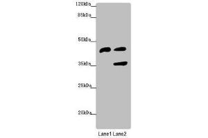 Western blot All lanes: SERPINB6 antibody at 0.