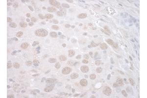 Immunohistochemistry (IHC) image for anti-Catenin, beta Like 1 (CTNNBL1) (AA 1-50) antibody (ABIN7448501) (CTNNBL1 Antikörper  (AA 1-50))