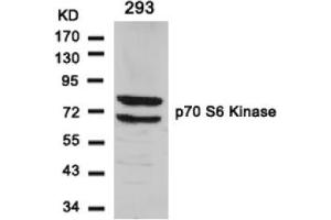 Image no. 3 for anti-Ribosomal Protein S6 Kinase, 70kDa, Polypeptide 1 (RPS6KB1) (Ser411) antibody (ABIN197526) (RPS6KB1 Antikörper  (Ser411))