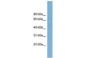 Western Blotting (WB) image for anti-Solute Carrier Family 2 (Facilitated Glucose Transporter), Member 12 (SLC2A12) (Middle Region) antibody (ABIN2781718)