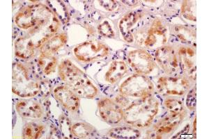 Immunohistochemistry (IHC) image for anti-serum/glucocorticoid Regulated Kinase Family, Member 3 (SGK3) (AA 40-90) antibody (ABIN1387590)