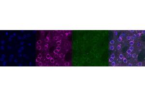 Immunohistochemistry (IHC) image for anti-Kv Channel Interacting Protein 2 (KCNIP2) antibody (ABIN7456313) (KCNIP2 Antikörper)