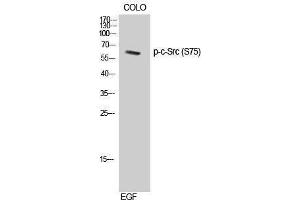 Western Blotting (WB) image for anti-Proto-oncogene tyrosine-protein kinase Src (Src) (pSer75) antibody (ABIN3182677) (Src Antikörper  (pSer75))