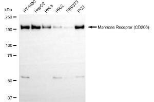 Western blotting analysis using mannose receptor (CD206) antibody (ABIN7799329). (Rekombinanter Mannose Receptor Antikörper)