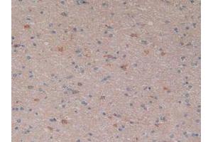IHC-P analysis of Human Brain Tissue, with DAB staining. (NFkB Antikörper  (AA 805-892))