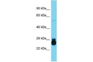 Host:  Rabbit  Target Name:  Hoxc6  Sample Type:  Rat Small Intestine lysates  Antibody Dilution:  1.