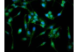 Immunofluorescence staining of Hela cells with ABIN7143093 at 1:100, counter-stained with DAPI. (ARPC4 Antikörper  (AA 2-168))