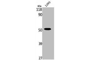 Western Blot analysis of LOVO cells using Phospho-MOR-1 (S375) Polyclonal Antibody (Mu Opioid Receptor 1 Antikörper  (pSer375))