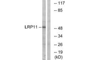 Western blot analysis of extracts from Jurkat cells, using LRP11 Antibody. (LRP11 Antikörper  (AA 48-97))