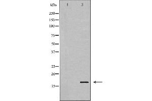 Western blot analysis of Stathmin 1 expression in Jurkat cells. (Stathmin 1 Antikörper  (N-Term))