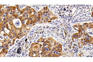 Immunohistochemistry (IHC) image for anti-Keratin 17 (KRT17) (AA 252-393) antibody (ABIN7434125)