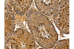 ABIN7094361 and ABIN7098408 at 1/100 staining Mouse testis tissue by IHC-P. (MIPEP Antikörper  (C-Term))