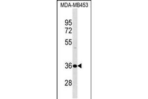 Western blot analysis in MDA-MB453 cell line lysates (35ug/lane). (DNAJB2 Antikörper  (N-Term))