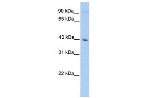 ODF2 antibody used at 1 ug/ml to detect target protein. (ODF2 Antikörper  (N-Term))