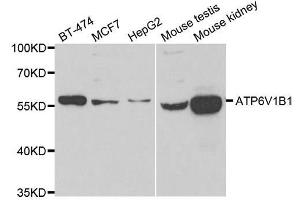 Western blot analysis of extracts of various cell lines, using ATP6V1B1 antibody. (ATP6V1B1 Antikörper  (AA 1-280))