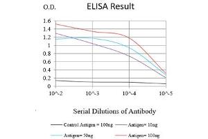 Black line: Control Antigen (100 ng),Purple line: Antigen (10 ng), Blue line: Antigen (50 ng), Red line:Antigen (100 ng) (ADAM10 Antikörper)