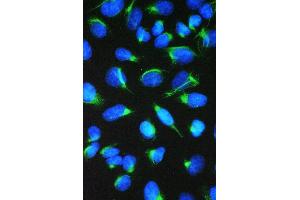 IF analysis of CCT7 using anti-CCT7 antibody (ABIN5692966). (CCT7 Antikörper  (AA 30-307))