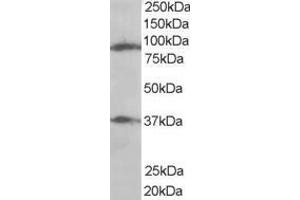 Western Blotting (WB) image for anti-ELKS/RAB6-Interacting/CAST Family Member 1 (ERC1) (N-Term) antibody (ABIN2465645) (ERC1 Antikörper  (N-Term))