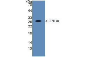Western blot analysis of recombinant Human Bid. (BID Antikörper  (AA 1-195))