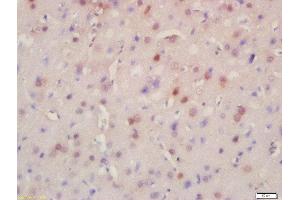 Formalin-fixed and paraffin embedded rat brain labeled with Rabbit Anti-BRD8 Polyclonal Antibody, Unconjugated (ABIN716951) at 1:200 followed by conjugation to the secondary antibody and DAB staining (BRD8 Antikörper  (AA 331-430))