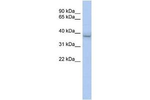 WB Suggested Anti-KLHDC8B Antibody Titration:  0.