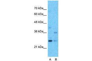 Host:  Rabbit  Target Name:  M96  Sample Type:  Hela  Lane A:  Primary Antibody  Lane B:  Primary Antibody + Blocking Peptide  Primary Antibody Concentration:  1ug/ml  Peptide Concentration:  5ug/ml  Lysate Quantity:  25ug/lane/lane  Gel Concentration:  0. (MTF2 Antikörper  (Middle Region))
