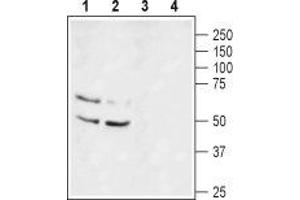 Western blot analysis of rat brain lysate (lanes 1 and 3) and mouse brain lysate (lanes 2 and 4): - 1,2. (KCNA1 Antikörper  (1st Extracellular Loop))