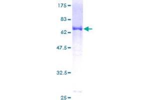 Image no. 1 for SUMO1 Activating Enzyme Subunit 1 (SAE1) (AA 1-346) protein (GST tag) (ABIN1319108) (SAE1 Protein (AA 1-346) (GST tag))