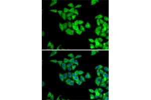 Immunofluorescence analysis of A-549 cells using NMT2 antibody (ABIN6130572, ABIN6144688, ABIN6144690 and ABIN6222825). (NMT2 Antikörper  (AA 1-120))