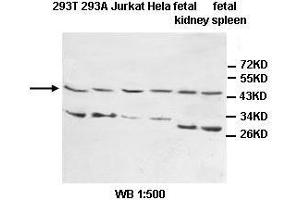 Image no. 1 for anti-Interleukin 1 Receptor, Type II (IL1R2) antibody (ABIN1577241) (IL1R2 Antikörper)