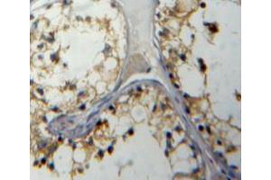 Used in DAB staining on fromalin fixed paraffin-embedded testis tissue (IL5RA Antikörper  (AA 42-182))