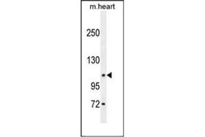 Western blot analysis of DAGLA Antibody in Mouse heart tissue lysates (35ug/lane).