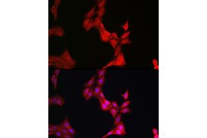 Immunofluorescence analysis of PC-12 cells using Glucocorticoid Receptor Rabbit pAb (ABIN3023090, ABIN3023091, ABIN3023092, ABIN1513281 and ABIN6219384) at dilution of 1:200 (40x lens).