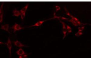 ABIN6274595 staining Hela by IF/ICC. (OB Cadherin Antikörper  (Internal Region))