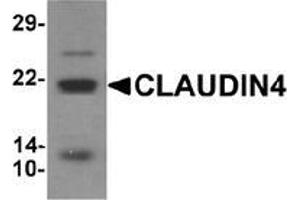 Western blot analysis of CLAUDIN4 in human colon tissue lysate with CLAUDIN4 Antibody  at 1 μg/ml. (Claudin 4 Antikörper  (C-Term))