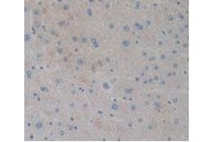 Detection of CCK8 in Human Liver Tissue using Monoclonal Antibody to Cholecystokinin 8 (CCK8) (CCK8 Antikörper)