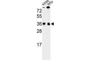 Western Blotting (WB) image for anti-serine/arginine-Rich Splicing Factor 1 (SRSF1) antibody (ABIN3002837)