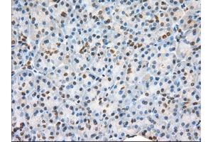 Immunohistochemical staining of paraffin-embedded liver tissue using anti-H6PD mouse monoclonal antibody. (Glucose-6-Phosphate Dehydrogenase Antikörper)