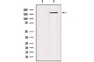 Western blot analysis of extracts from HUVEC, using ABCC5  Antibody.
