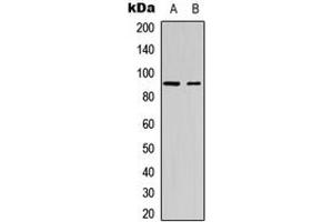Western blot analysis of SP1 (pT453) expression in Jurkat (A), mouse melanoma cancer (B) whole cell lysates. (SP1 Antikörper  (pSer453))